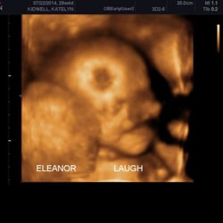 Tiny Miracles 3D/4D Prenatal Imaging