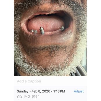 CG Smile - 4 years of unfinished dental work and I am told by staff that CG Smiles has done ALL that they can do. - Cosmetic Dentists Near Me - Miami, Florida