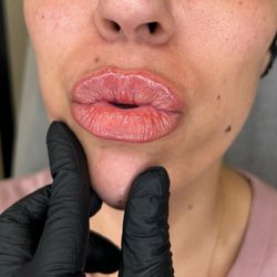 Bella Glo Medical Aesthetics & Wellness - Perfect lips