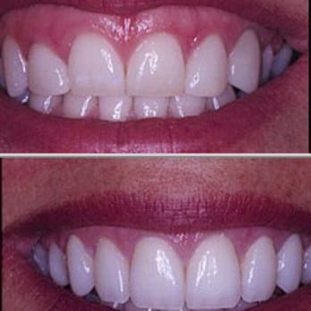 SoCal Smile Care  - Cosmetic Dentists Near Me - Carson, California