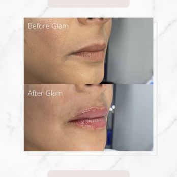 Glam Lab - Weight Loss Centers Near Me - Orlando, Florida Glam Lab - Weight Loss Centers Near Me - Orlando, Florida