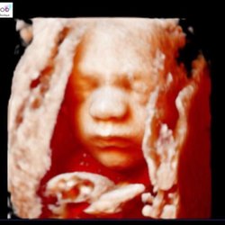 Peek-A-Boo 3D/4D Ultrasound and Baby Boutique