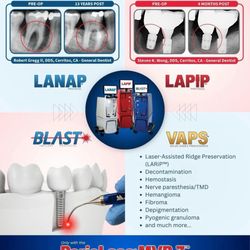 Legacy Periodontics & Implant Center - We save the Hopeless teeth & Implants and avoid extractions. Because it deserves a second chance and little TLC.