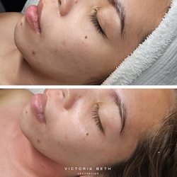Look at that glow! True oxygen therapy achieved through a DMK Enzyme. Flush away toxins and stop aging in its tracks.