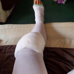 De La Vina Surgicenter Medical Group - Meniscus Surgery