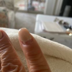 Ballantyne Nail Spa - Chipped nails. 5 days after sns. First day paint all over fingers. Day 4 pink color turned yellow. Day 5 all nails chipping.
