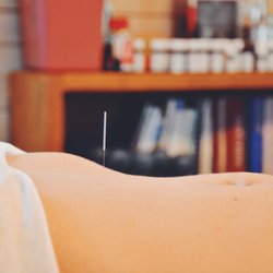 East End Acupuncture Associates