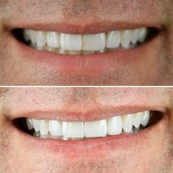 Kallos Dental Aesthetics