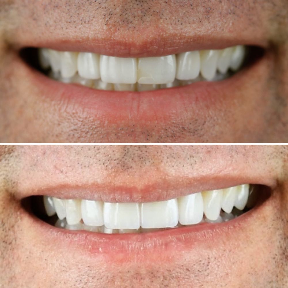 Kallos Dental Aesthetics Logo