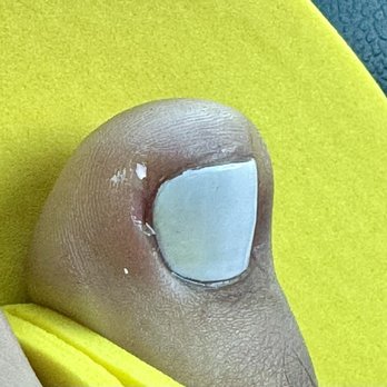 Nails By Ann & lounge - Tore off my cuticle and made it bleed. Btw, this is the finished product of my pedi. - Nail Salons Near Me - San Diego, California Nails By Ann & lounge - Tore off my cuticle and made it bleed. Btw, this is the finished product of my pedi. - Nail Salons Near Me - San Diego, California