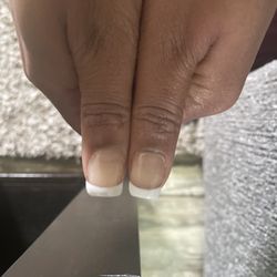 JNS Nails - One super thick thumb nail. The other is more natural looking