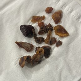 Seeds