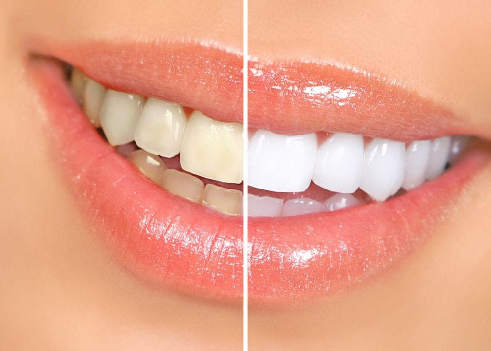 Ultimate Smile Studio Logo