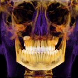 Smiles by Hazen - I-CAT 3D Imaging