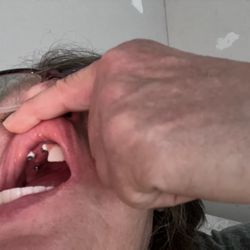 Mansouri Family Dental Care & Associates - No teeth