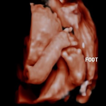 Stork Vision Madison - Ultrasound Imaging Centers Near Me - Madison, Wisconsin Stork Vision Madison - Ultrasound Imaging Centers Near Me - Madison, Wisconsin