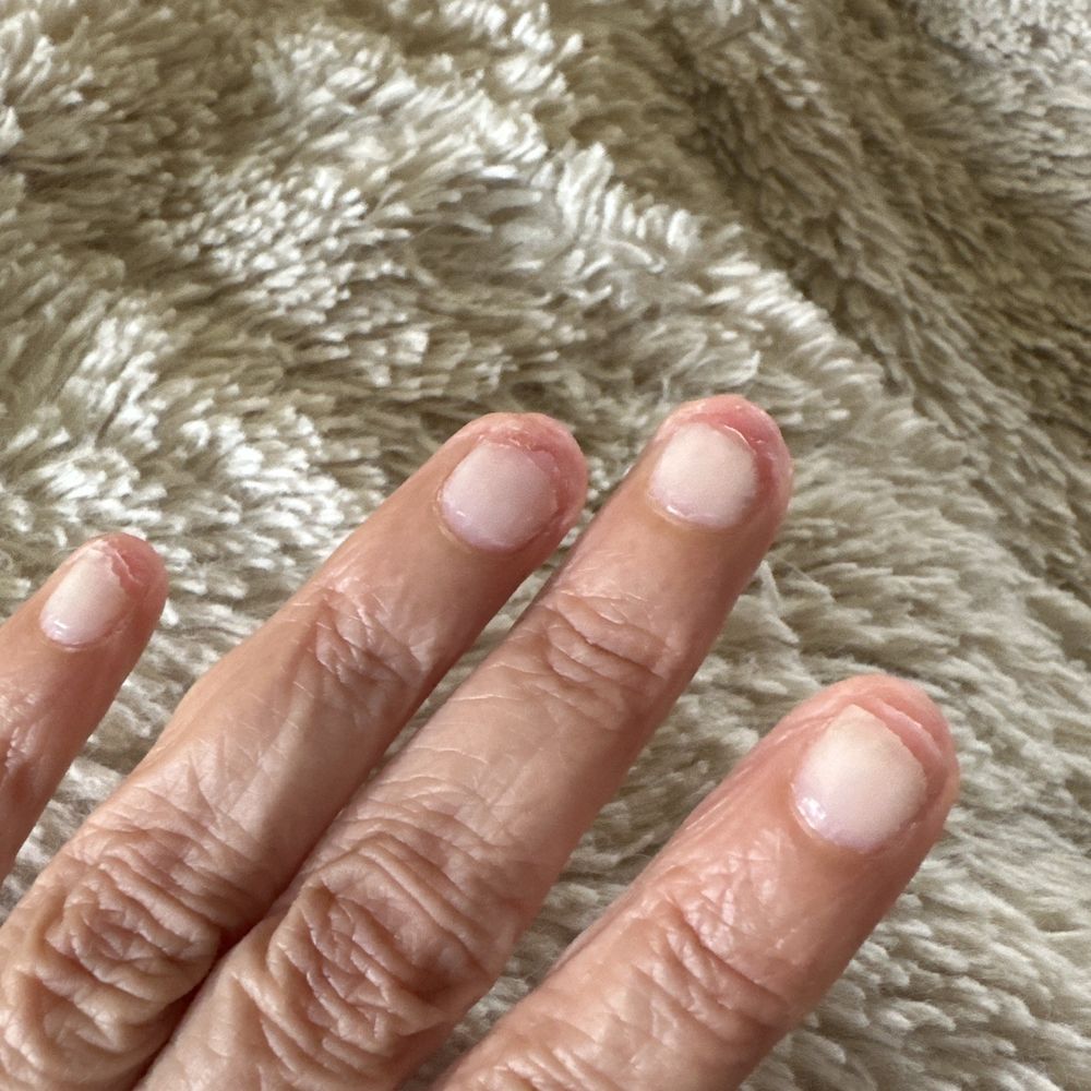 Eco Nail Lounge - Nails 10 days after gel removal - Nail Salons Near Me - Elk Grove, California