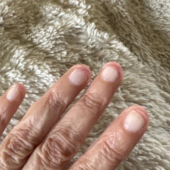 Eco Nail Lounge - Nails 10 days after gel removal - Nail Salons Near Me - Elk Grove, California Eco Nail Lounge - Nails 10 days after gel removal - Nail Salons Near Me - Elk Grove, California