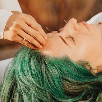 Jenny Ahn Wellness - Acupuncture Near Me - Long Beach, California