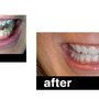 Charles S Hand, DDS