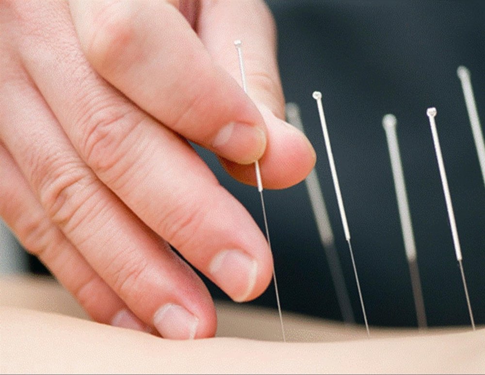 Serenity Alternative Healthcare & Acupuncture Center Image
