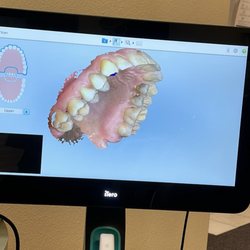 Alsbury Dental - How cool is this technology?