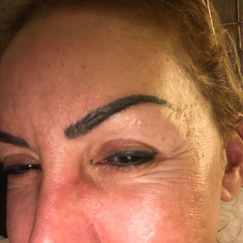 Millennium Medical: Dr. Rassael - They claimed it was Botox. Two weeks after Botox. - Cosmetic Surgeons Near Me - Chevy Chase, Maryland Millennium Medical: Dr. Rassael - They claimed it was Botox. Two weeks after Botox. - Cosmetic Surgeons Near Me - Chevy Chase, Maryland