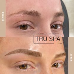 Tru Spa by Heba - Microbalding
