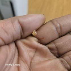 Capital ENT & Sinus Center - Plastic earring-back