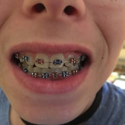Leonard Leon J Ms DMD - Braces.