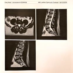 Daniel L Kim, MD - Indiana Spine Group