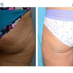 Advanced Therapeutics - Cosmetic Surgery and Rejuvenation