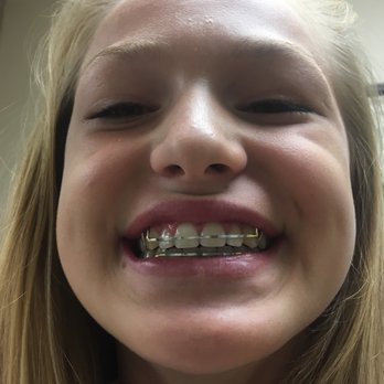 Temecula Orthodontic Group - Orthodontists Near Me - Temecula, California