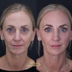 Soul And Beauty Medx - Before and after