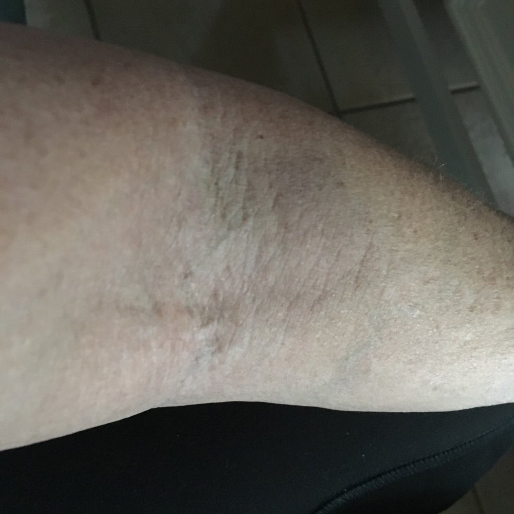 Labcorp - 4dsys later 4 sticks - Laboratory Testing Near Me - San Ramon, California Labcorp - 4dsys later 4 sticks - Laboratory Testing Near Me - San Ramon, California