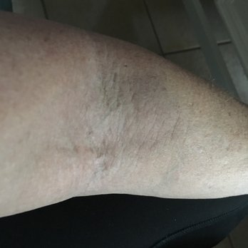 Labcorp - 4dsys later 4 sticks - Laboratory Testing Near Me - San Ramon, California Labcorp - 4dsys later 4 sticks - Laboratory Testing Near Me - San Ramon, California