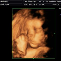 Sneak A Peek Imaging - 4D Ultrasound Houston 26 weeks. Awesome images of scan
