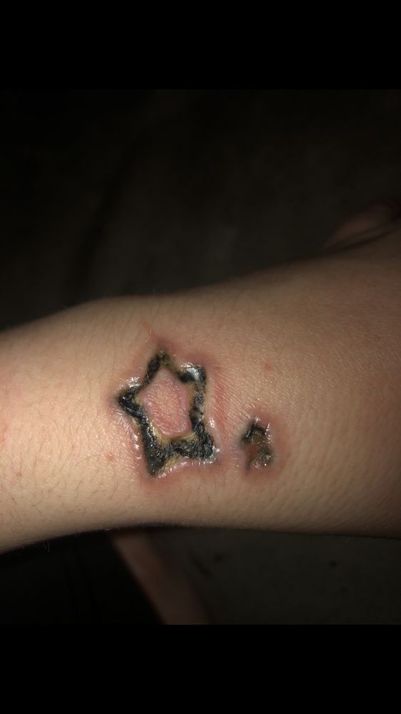 COMPLETE LASER CLINIC ASHEVILLE Updated August 2024 3 S Tunnel Rd