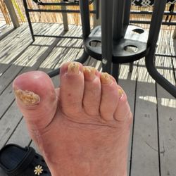 Comfy Nails - This is the work the Manager did on my toenails