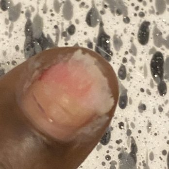 Top Nails - This is all the way to the meat broken straight across - Nail Salons Near Me - Fort Worth, Texas