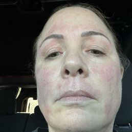 Right after appointment Right after appointment