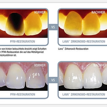vFM Dentallabor - Health & Medical Near Me - Hamburg, HH vFM Dentallabor - Health & Medical Near Me - Hamburg, HH