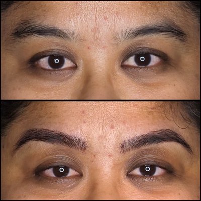 Before and After Microblading - Discover the artistry of microblading. Our skilled technicians meticulously craft natural-looking brows using microblading, a semi-permanent technique that delivers long-lasting results. Experience the confidence-boosting transformation as we tailor each stroke to complement your unique facial features. Elevate your aesthetic game with our premier microblading services Before and After Microblading - Discover the artistry of microblading. Our skilled technicians meticulously craft natural-looking brows using microblading, a semi-permanent technique that delivers long-lasting results. Experience the confidence-boosting transformation as we tailor each stroke to complement your unique facial features. Elevate your aesthetic game with our premier microblading services