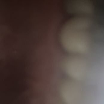 Jeff Gray DDS - Espire Dental - Mold - Cosmetic Dentists Near Me - La Mesa, California Jeff Gray DDS - Espire Dental - Mold - Cosmetic Dentists Near Me - La Mesa, California