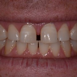 Michael A. Shustak, DMD - Sample 1: Before treatment photograph (see our website for more photographs)