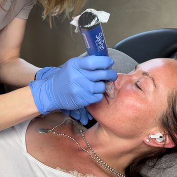Katie Estes - SkinPen Medical Microneedling - Medical Spas Near Me - Monterey, California
