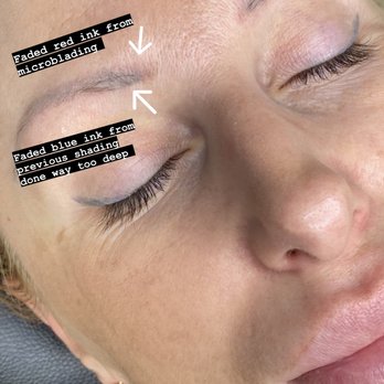 Sdlcbeauty - Before brow correction. brows were done by 2 different artists in the past and 2 different colors. lots of trauma on skin by previous artist - Permanent Makeup Near Me - Las Vegas, Nevada Sdlcbeauty - Before brow correction. brows were done by 2 different artists in the past and 2 different colors. lots of trauma on skin by previous artist - Permanent Makeup Near Me - Las Vegas, Nevada