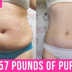 Fast Fit Body Sculpting Fat Weight Loss Review Before and After Skin Tightening
