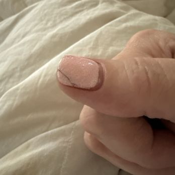 Adore Nail Lounge - These cracks happened on both sides of nearly every nail. - Nail Salons Near Me - Austin, Texas Adore Nail Lounge - These cracks happened on both sides of nearly every nail. - Nail Salons Near Me - Austin, Texas