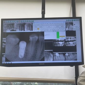 Amit Shah, DDS - Tustin Smile - Implant X-ray - General Dentistry Near Me - Tustin, California Amit Shah, DDS - Tustin Smile - Implant X-ray - General Dentistry Near Me - Tustin, California